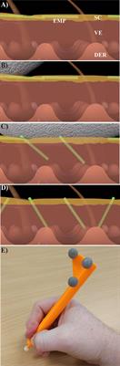 Motion Capture Quantification of User Variation in Topical Microparticle Application